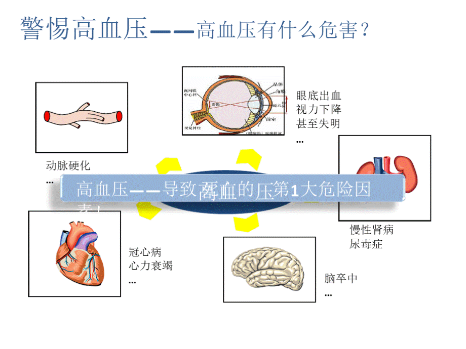 高血压教育社区宣讲ppt课件.pptx_第3页