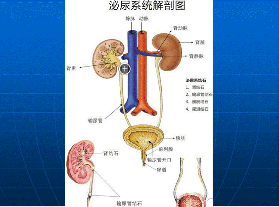 泌尿外科常见疾病的护理1医学PPT课件.pptx_第3页