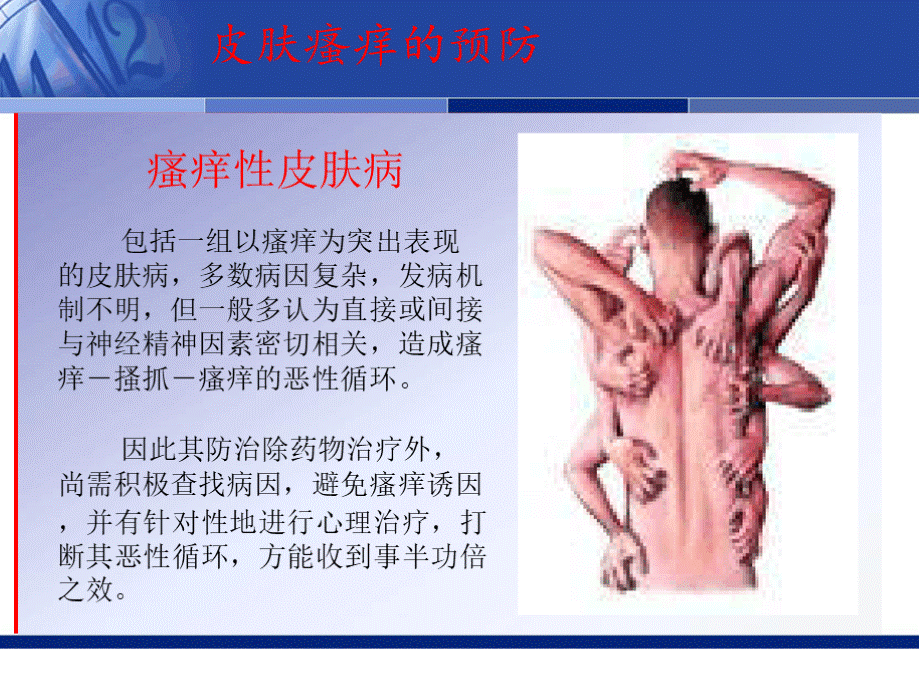 皮肤瘙痒的预防课件.pptx_第2页