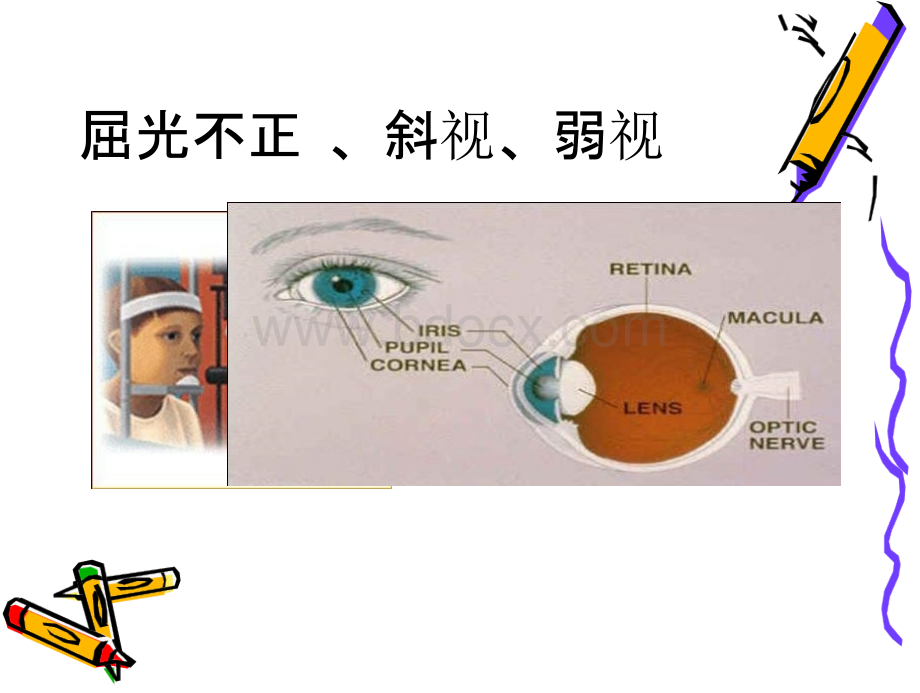 屈光不正、斜视、弱视PPT文件格式下载.pptx_第1页