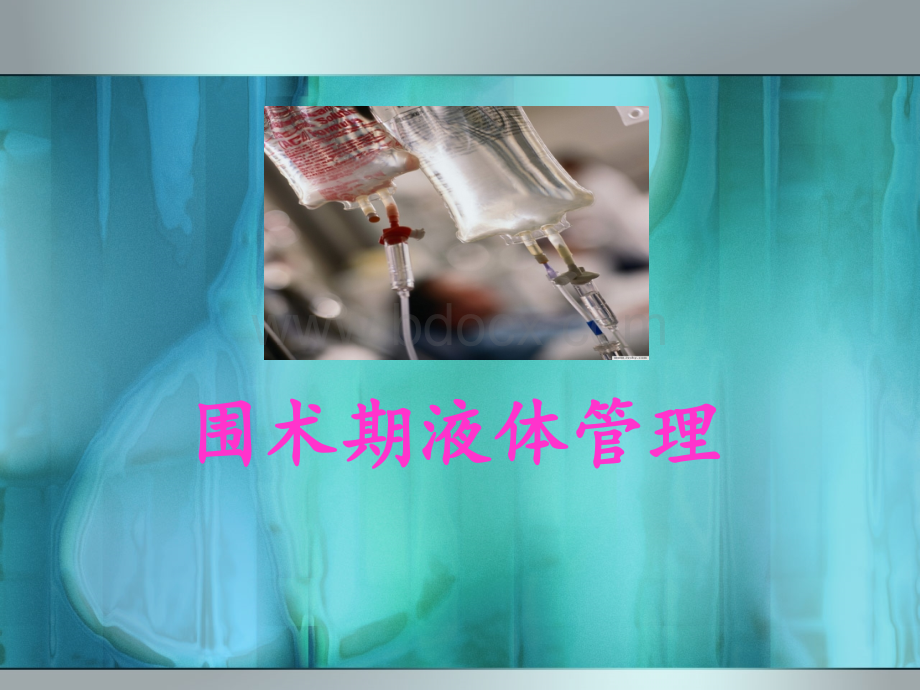 围术期液体管理PPT格式课件下载.ppt