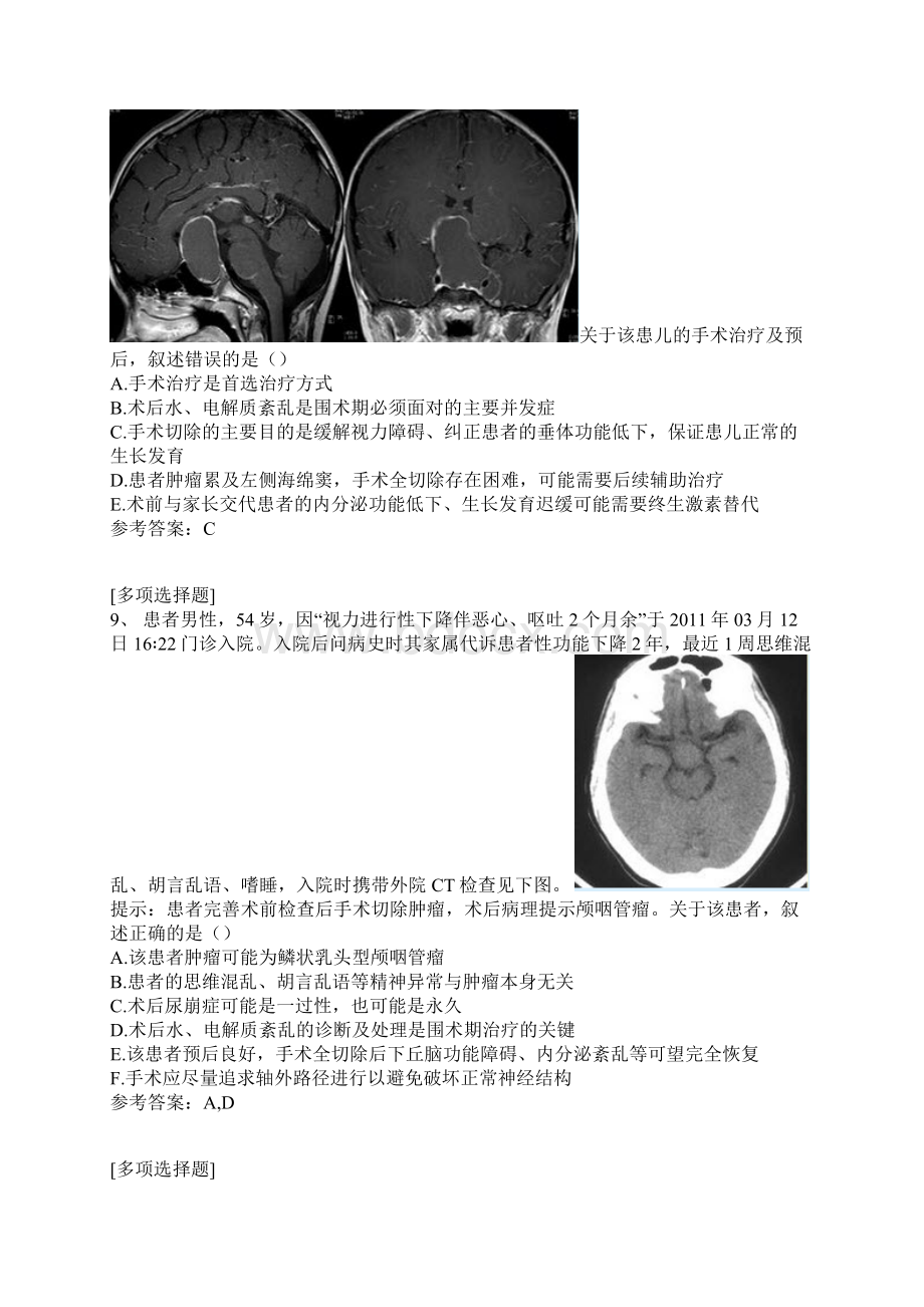 颅咽管瘤试题Word文档格式.docx_第3页