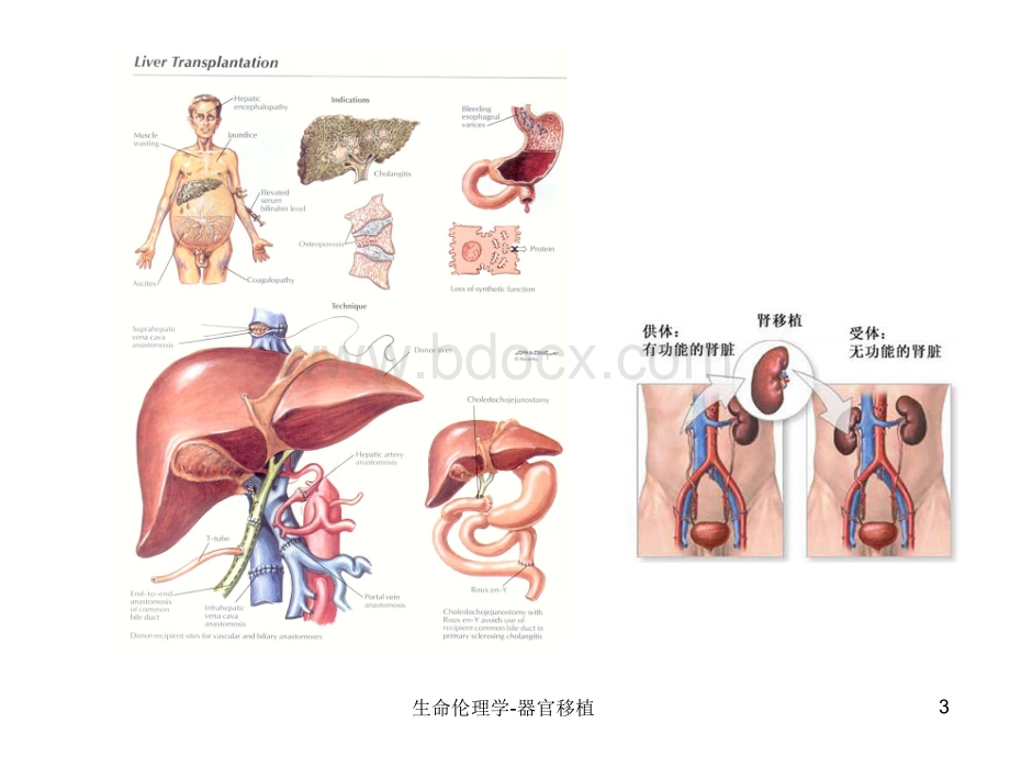 器官移植伦理优质PPT.ppt_第3页