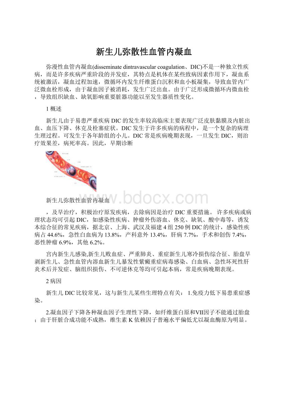 新生儿弥散性血管内凝血.docx_第1页