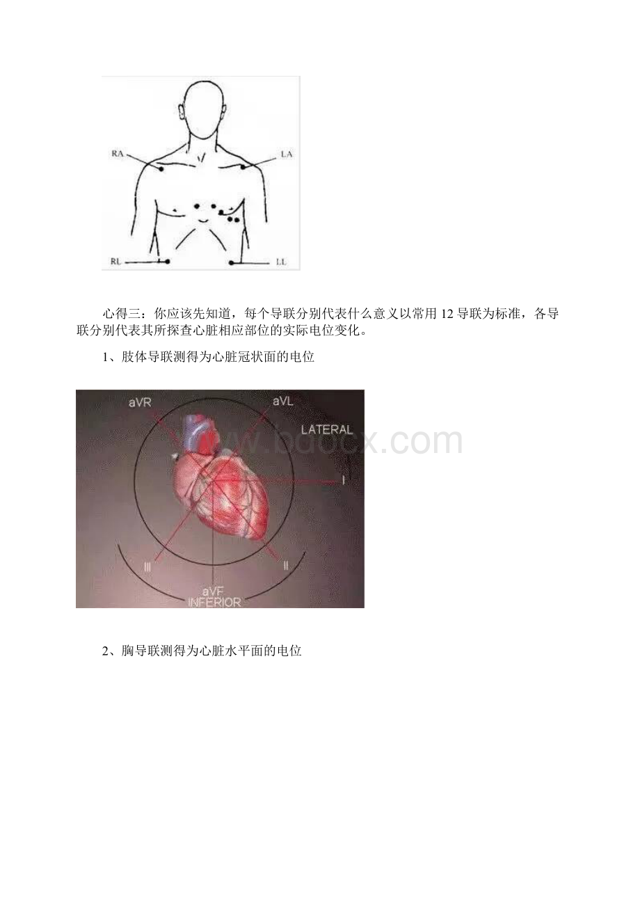 基础心电图速成宝典.docx_第3页