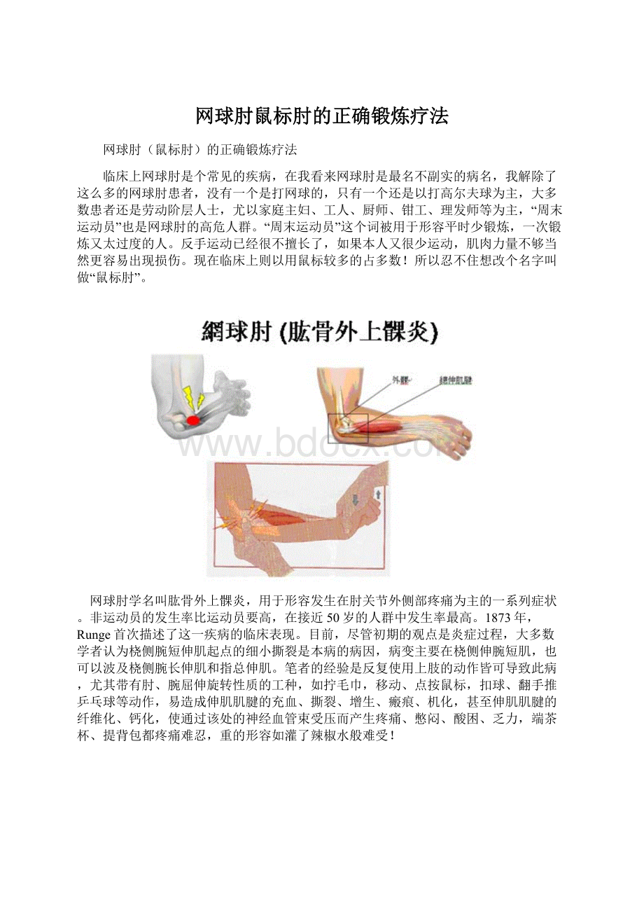 网球肘鼠标肘的正确锻炼疗法Word下载.docx