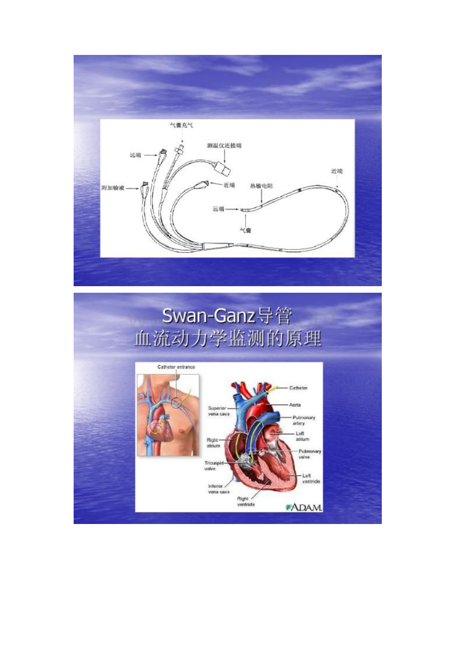 SwanGanz漂浮导管文档格式.docx_第3页