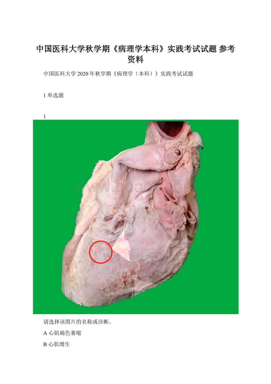 中国医科大学秋学期《病理学本科》实践考试试题 参考资料Word格式.docx