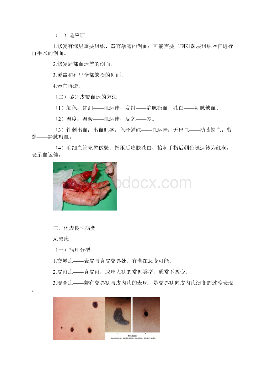 普外科中级资料整形外科专业知识Word文档格式.docx_第3页