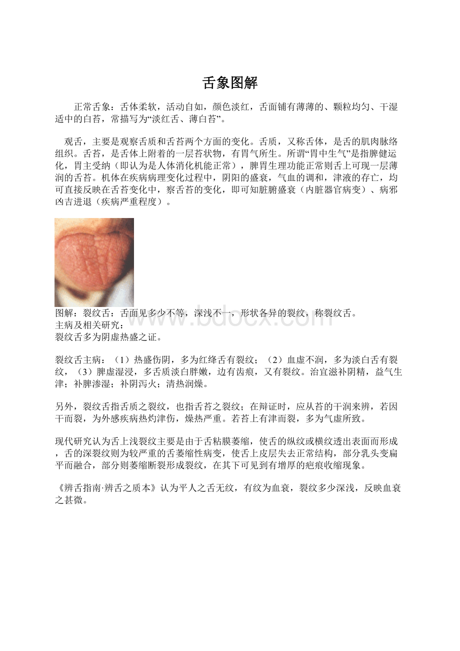 舌象图解.docx_第1页