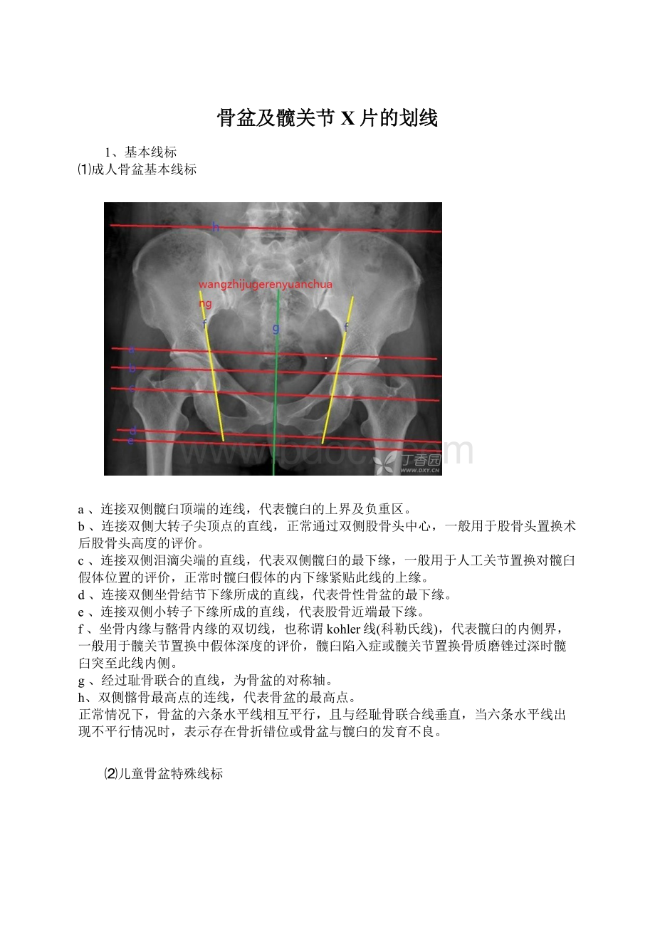 骨盆及髋关节X片的划线Word文档格式.docx