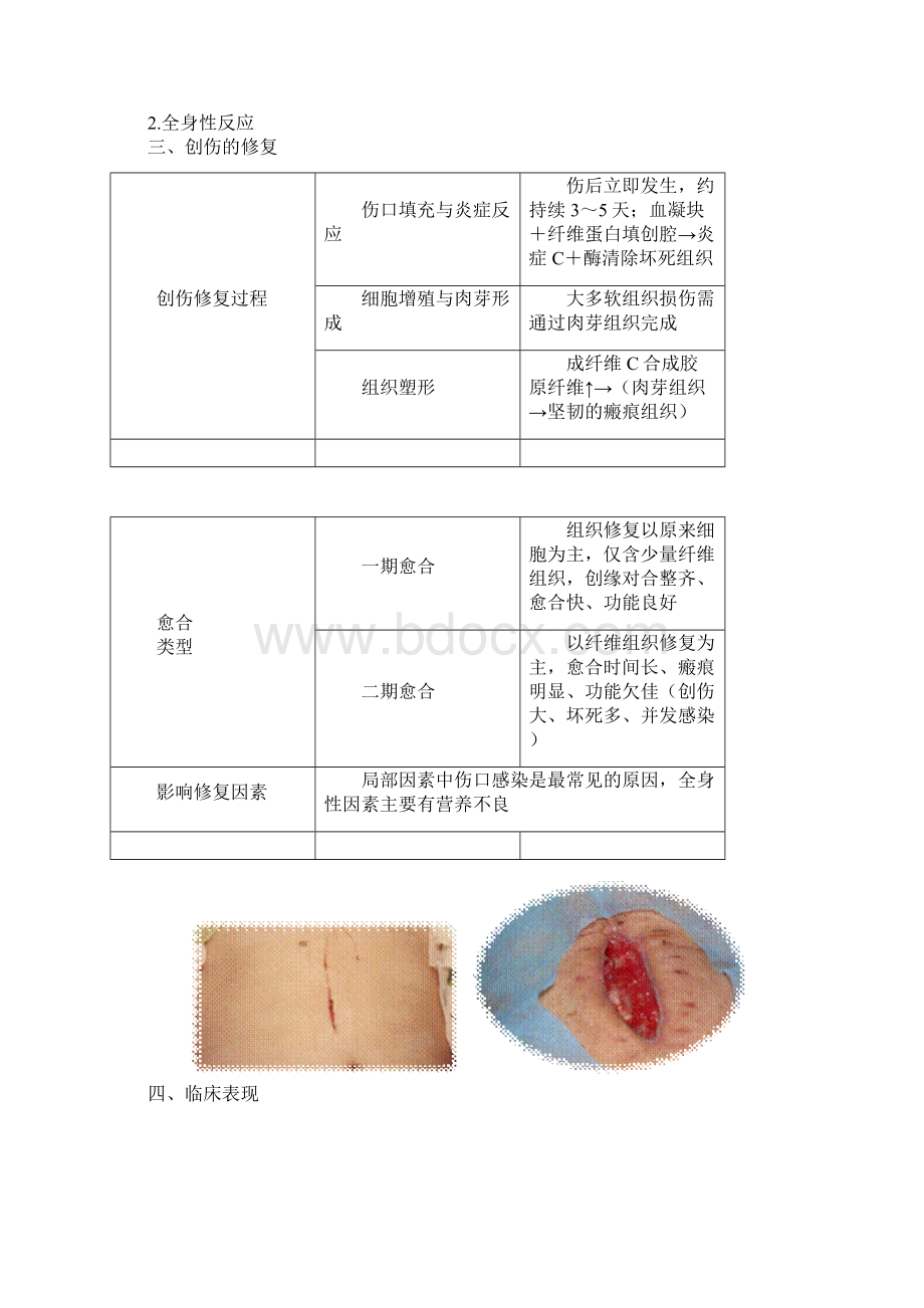 护士资格考试自学张老师精讲第十一章损伤中毒病人的护理Word文档下载推荐.docx_第2页