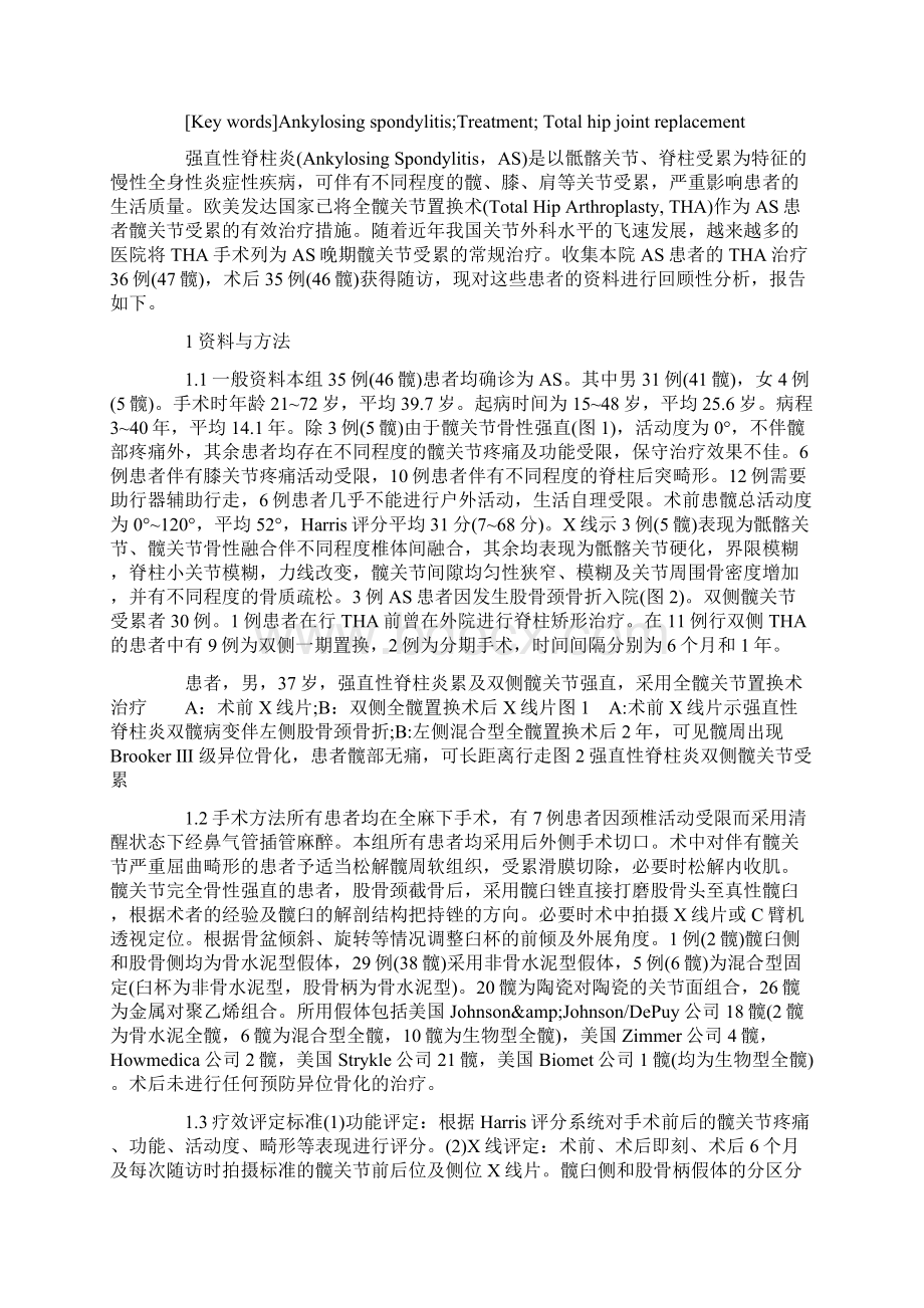 全髋关节置换术治疗强直性脊柱炎髋关节病变Word下载.docx_第2页