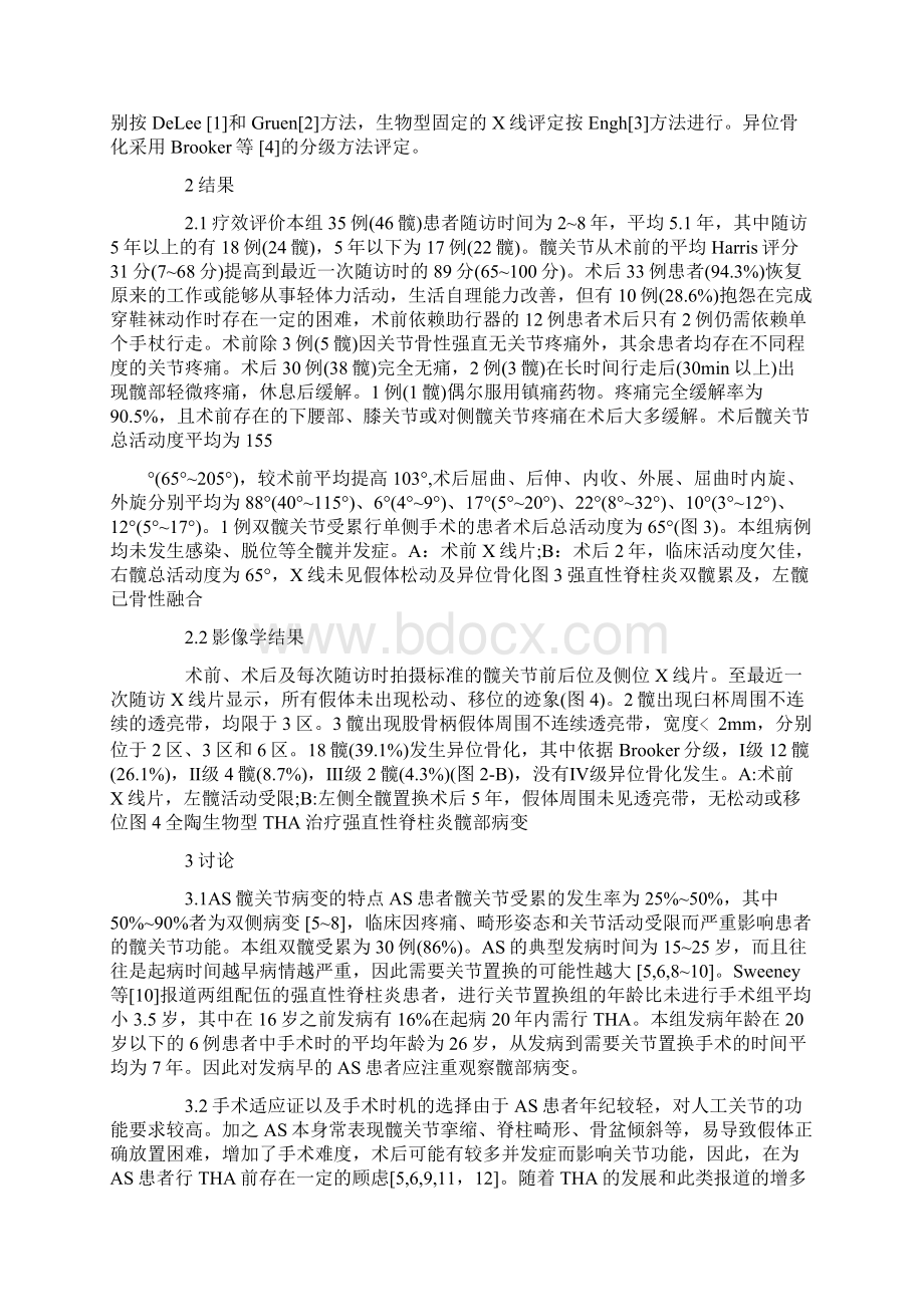 全髋关节置换术治疗强直性脊柱炎髋关节病变Word下载.docx_第3页