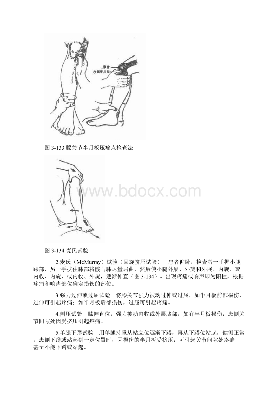 膝关节常见损伤Word文档格式.docx_第3页