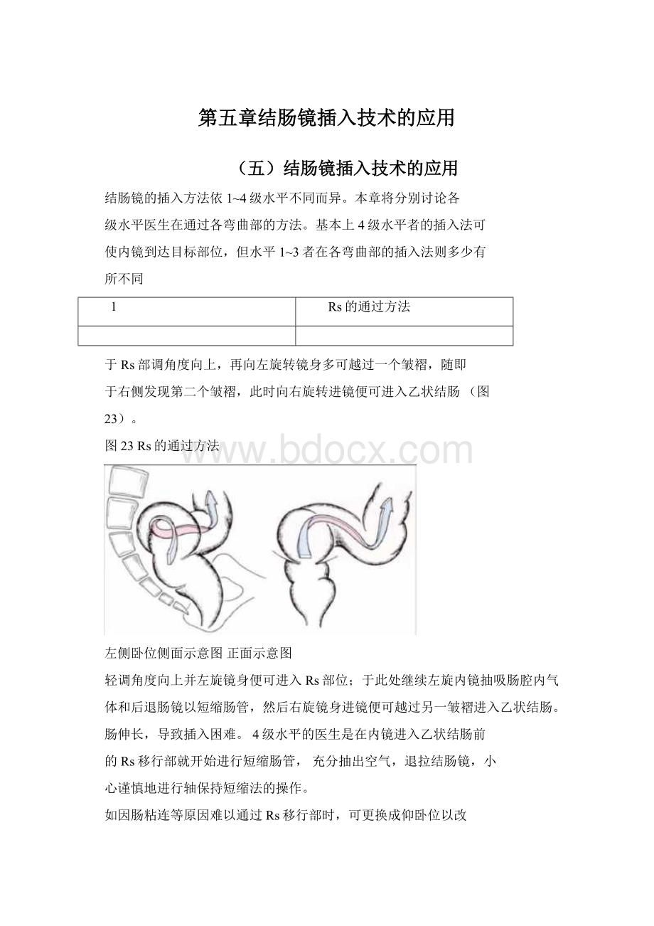 第五章结肠镜插入技术的应用Word文档下载推荐.docx