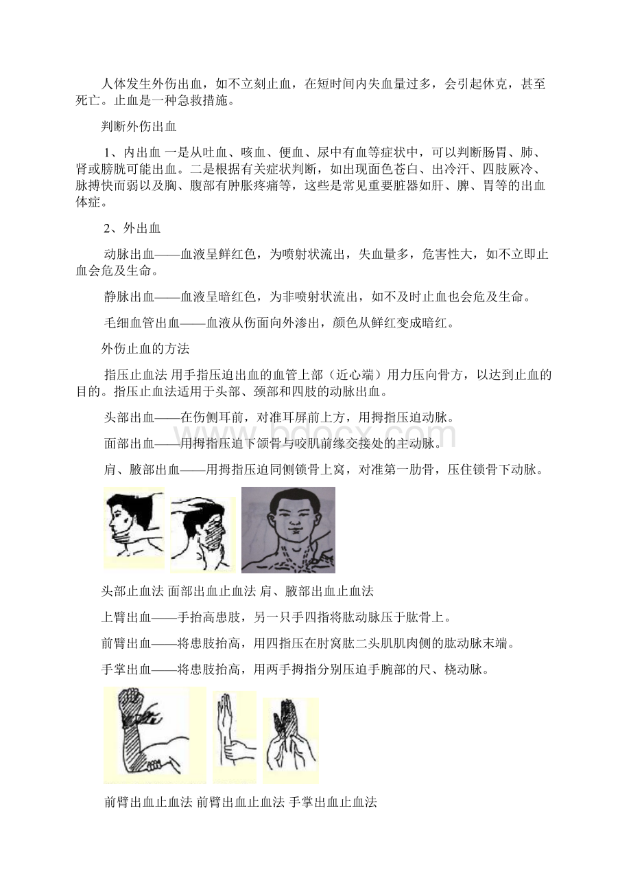 突发外伤处理Word下载.docx_第2页