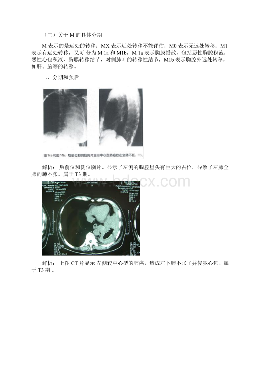 肺癌分期及预后精编版Word文件下载.docx_第3页