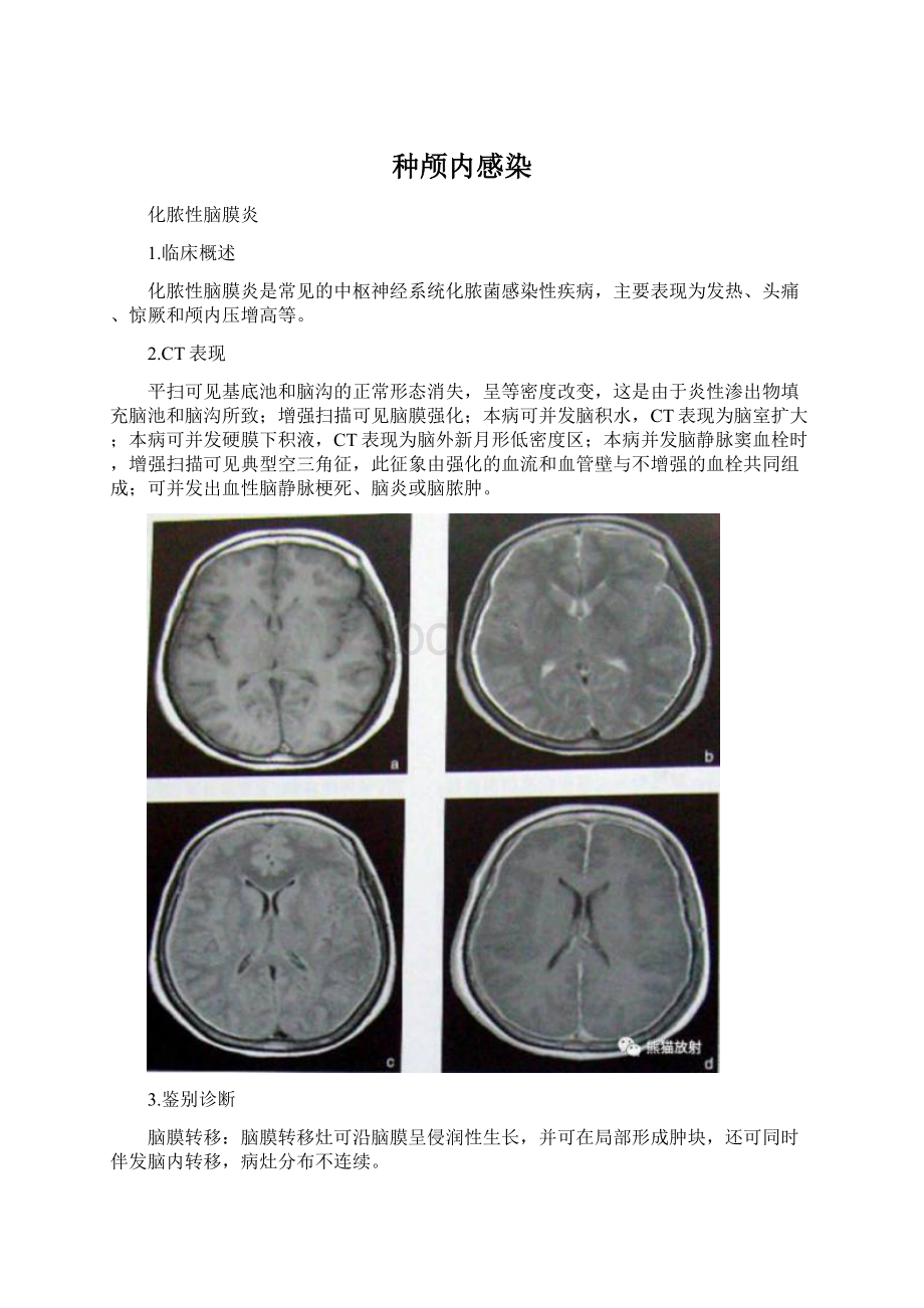 种颅内感染.docx