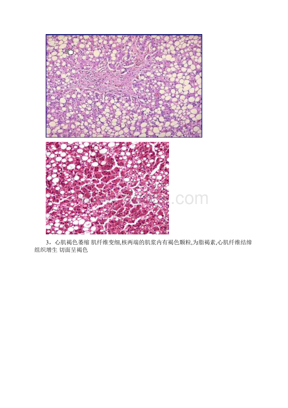 病理学切片和标本.docx_第2页