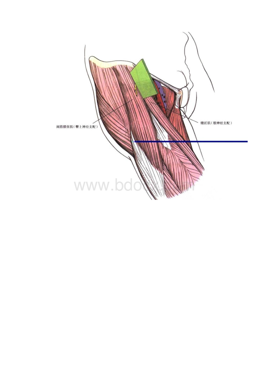 髋关节前侧入路SmithPetersenapproach.docx_第3页