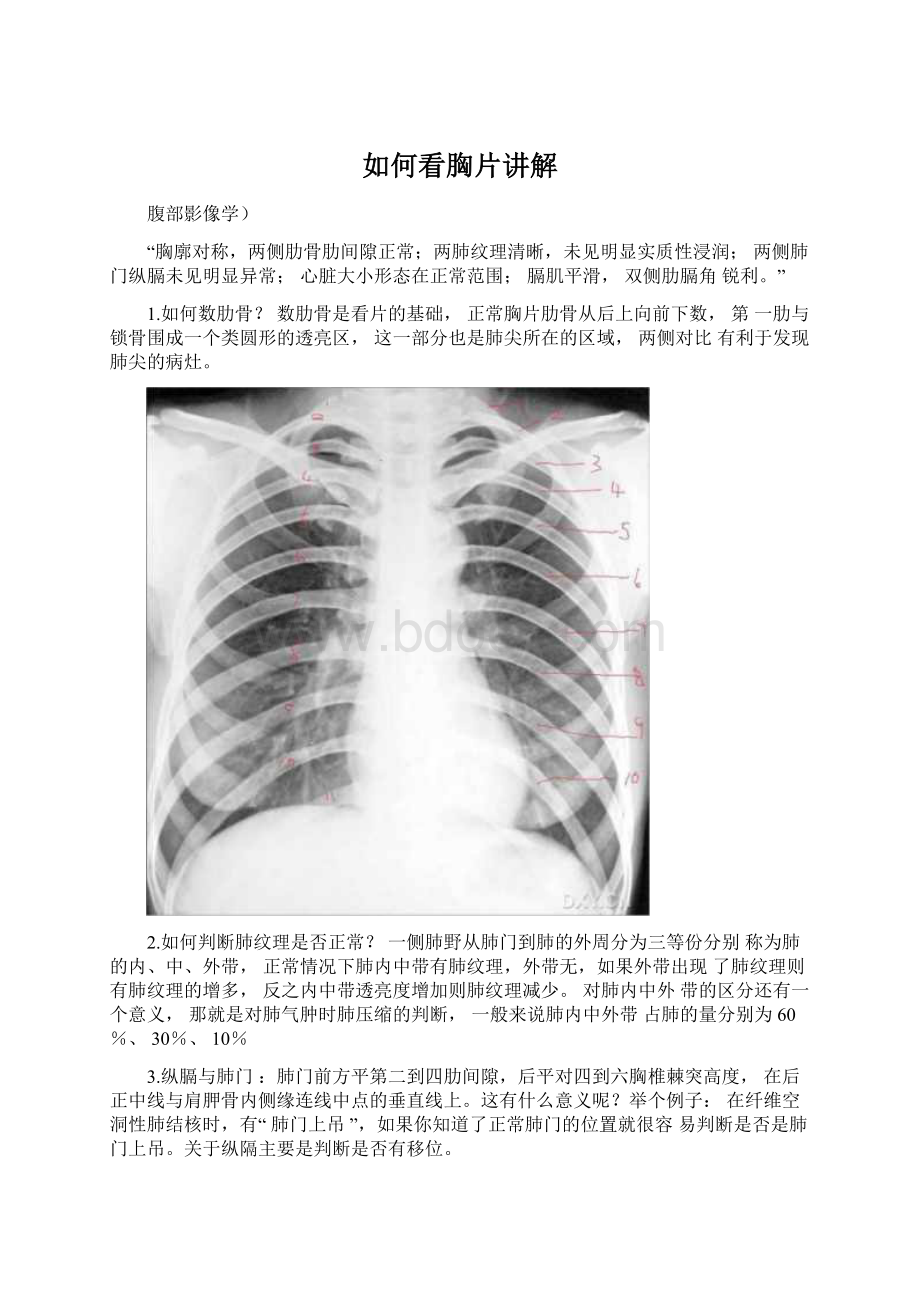 如何看胸片讲解Word文件下载.docx