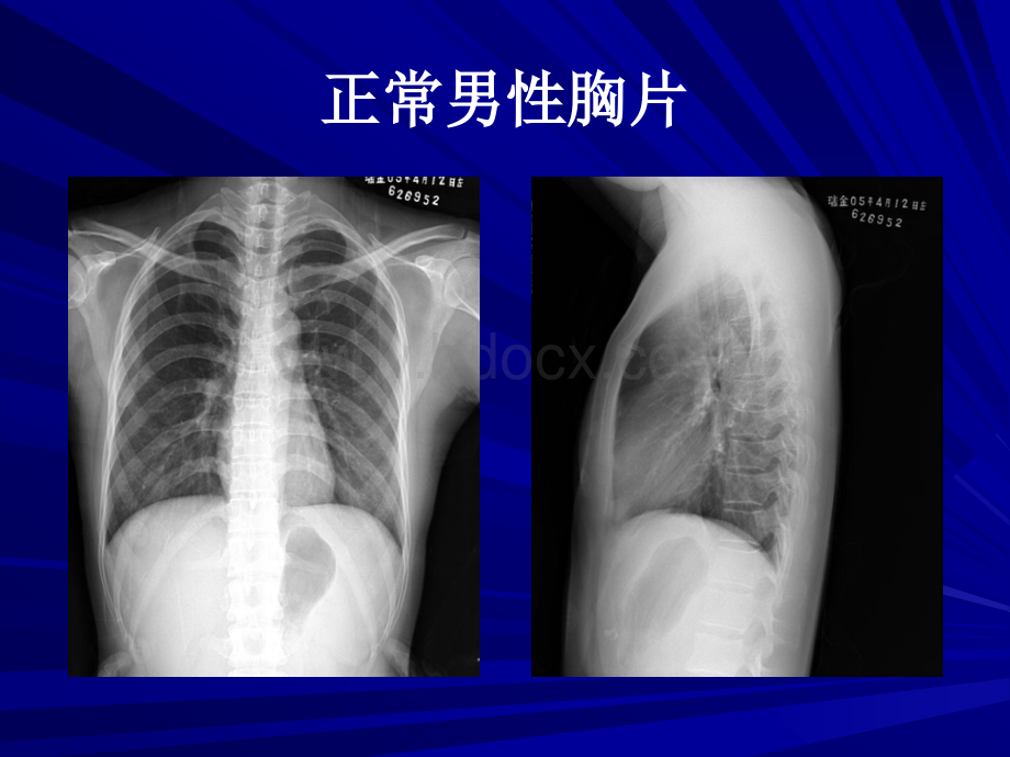 月胸部线基础读片PPT资料.ppt_第2页