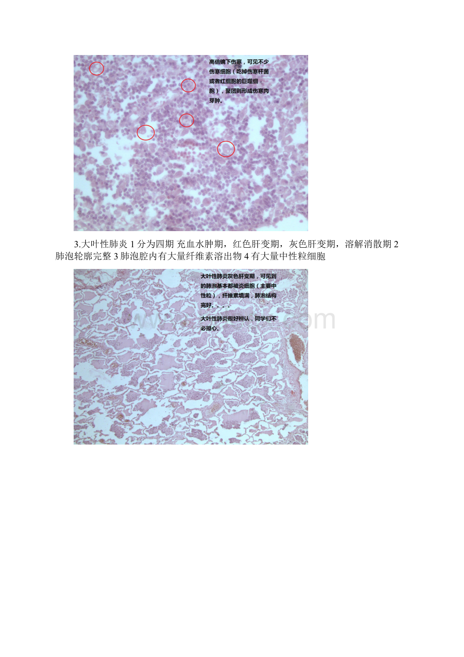 最新病理学切片考试整理.docx_第2页