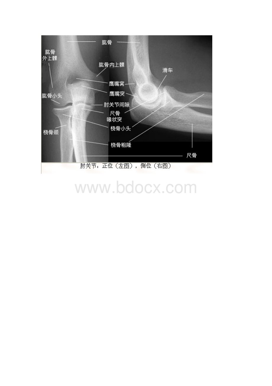 X线解剖绝版收藏文档格式.doc_第1页