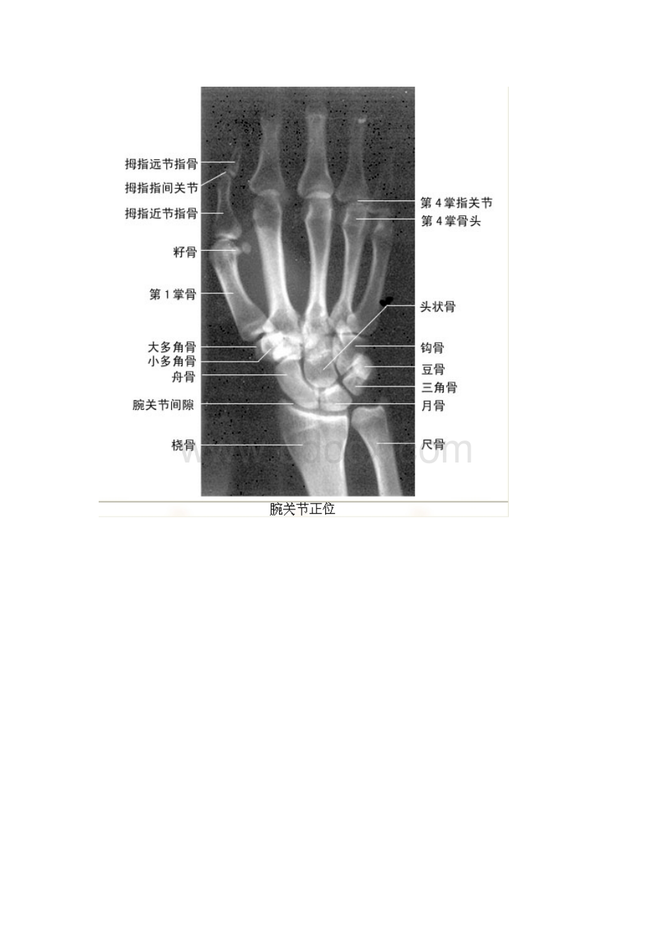 X线解剖绝版收藏文档格式.doc_第2页