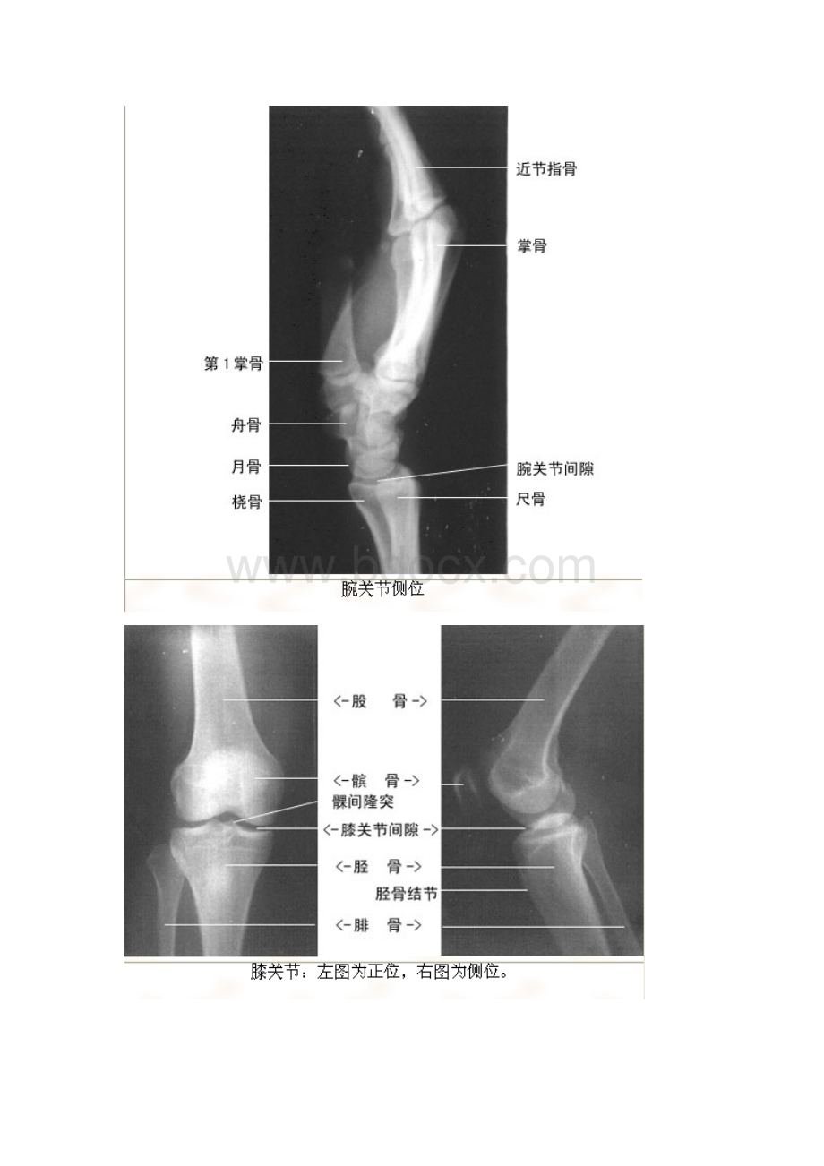 X线解剖绝版收藏文档格式.doc_第3页