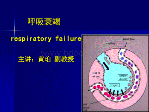 呼吸衰竭、ARDS.ppt