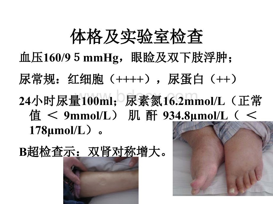 泌尿系统疾病01-肾小球肾炎优质PPT.ppt_第3页