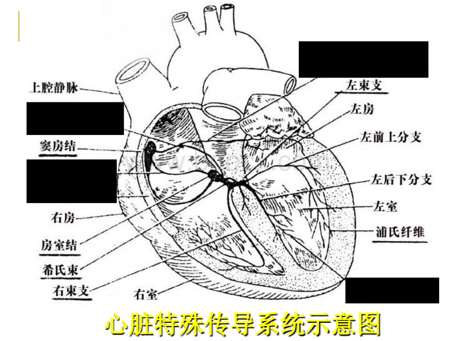 常见异常心电图的鉴别与诊断技巧ppt课件PPT推荐.ppt_第2页