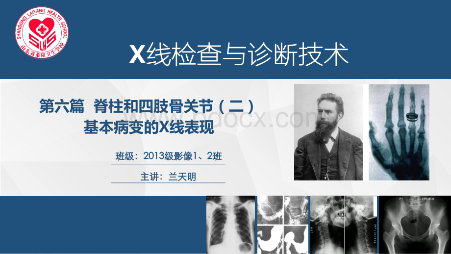 X线检查与诊断技术课件-第六篇骨关节二.pptx_第1页