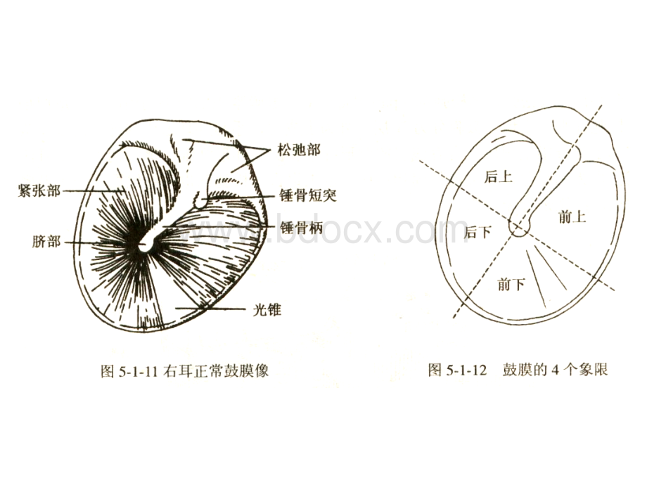 化脓性中耳炎及其并发症PPT资料.ppt_第3页