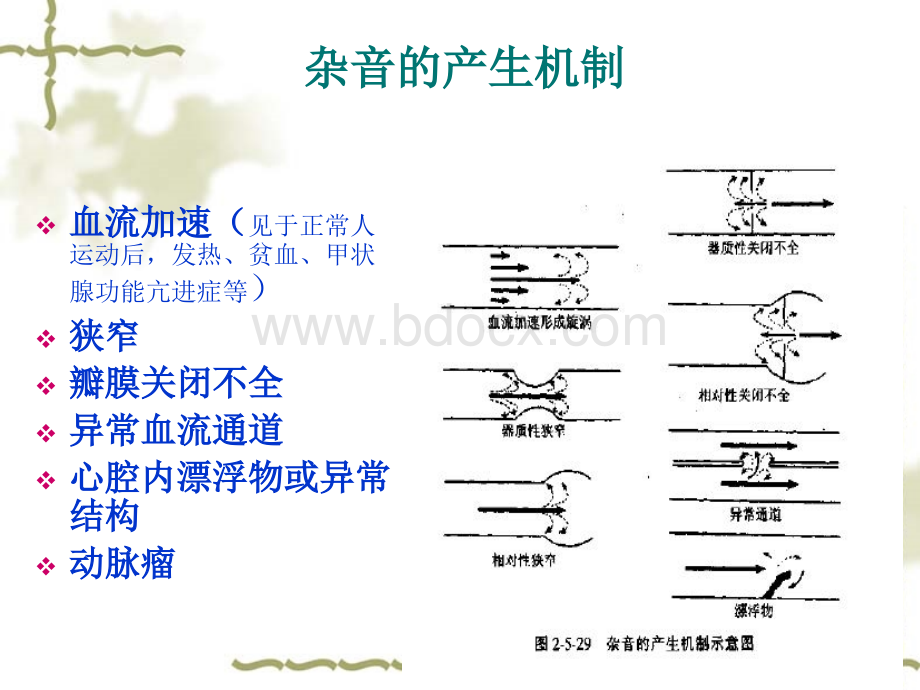 心脏听诊2五年制优质PPT.ppt_第3页