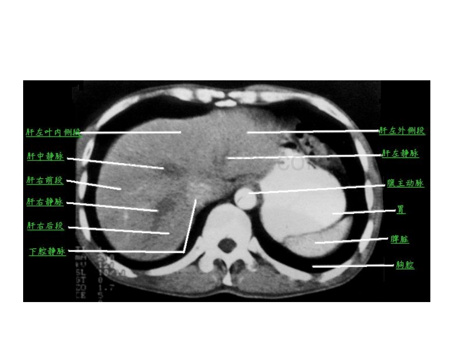腹部经典层面(横断面)解剖PPT格式课件下载.ppt_第2页