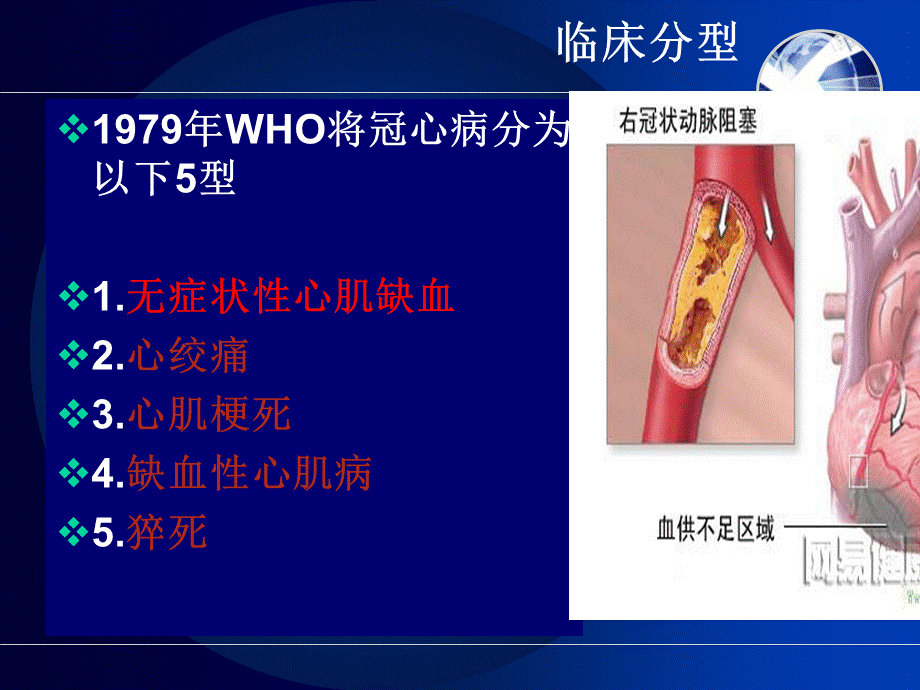 冠心病及介入术后护理ppt课件.ppt_第3页