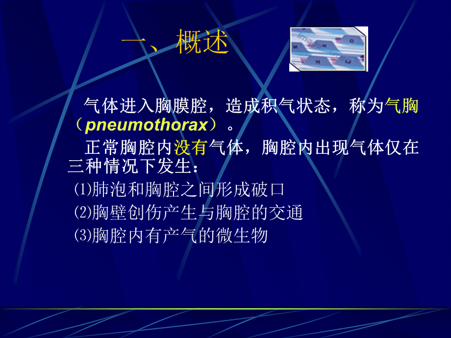 气胸幻灯11教学文稿PPT资料.ppt_第2页