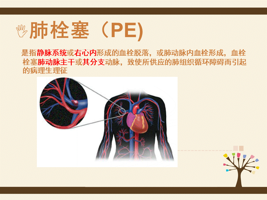 肺栓塞课件PPT文件格式下载.ppt_第3页