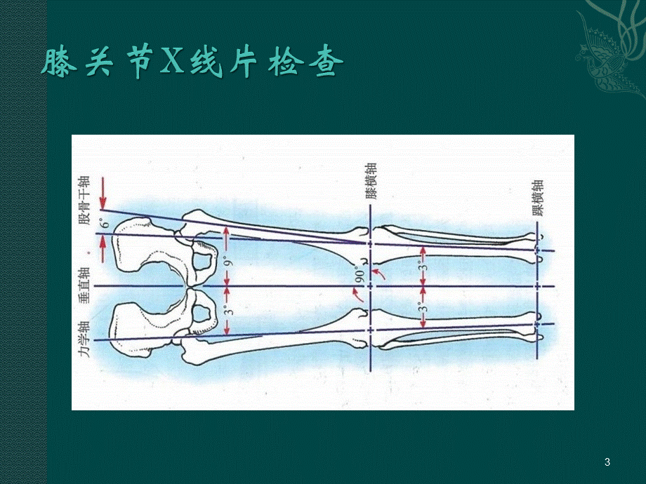 膝关节X线片检查ppt课件PPT文件格式下载.ppt_第3页