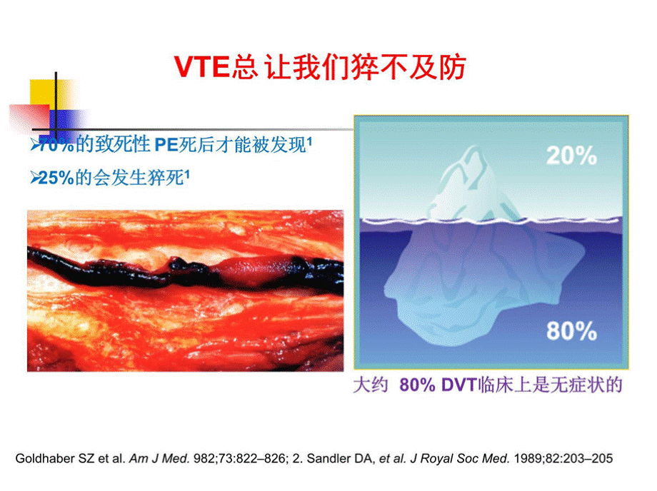 下肢深静脉血栓讲课经典教程.pptx_第3页