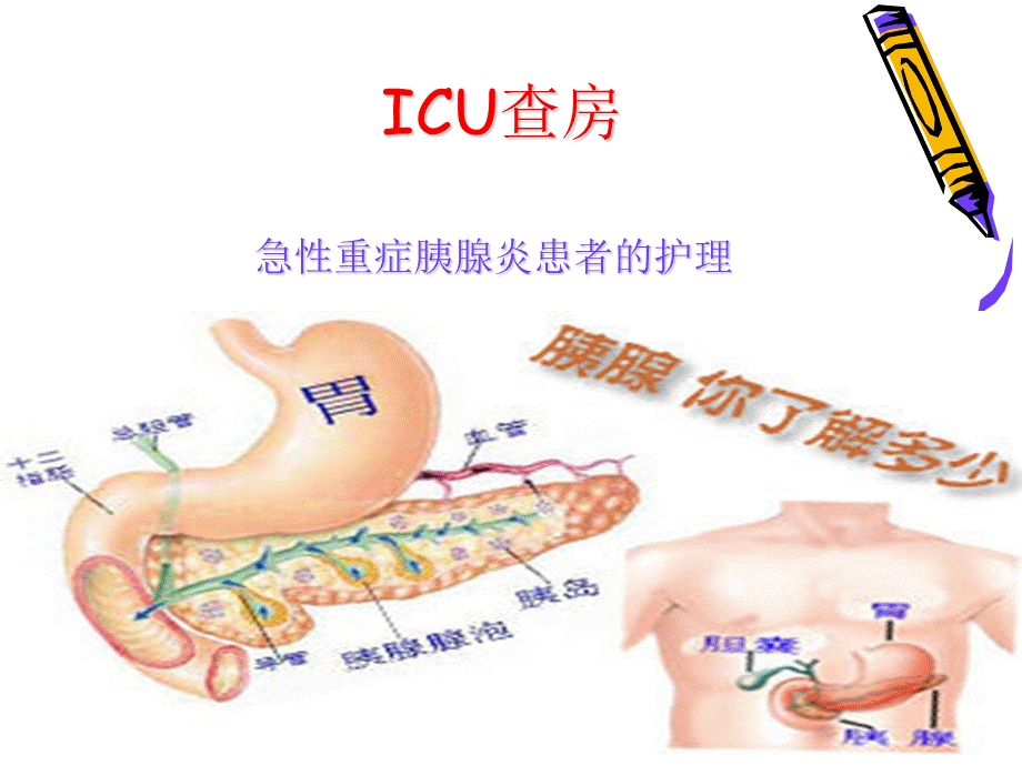 ICU查房(急性胰腺炎).ppt