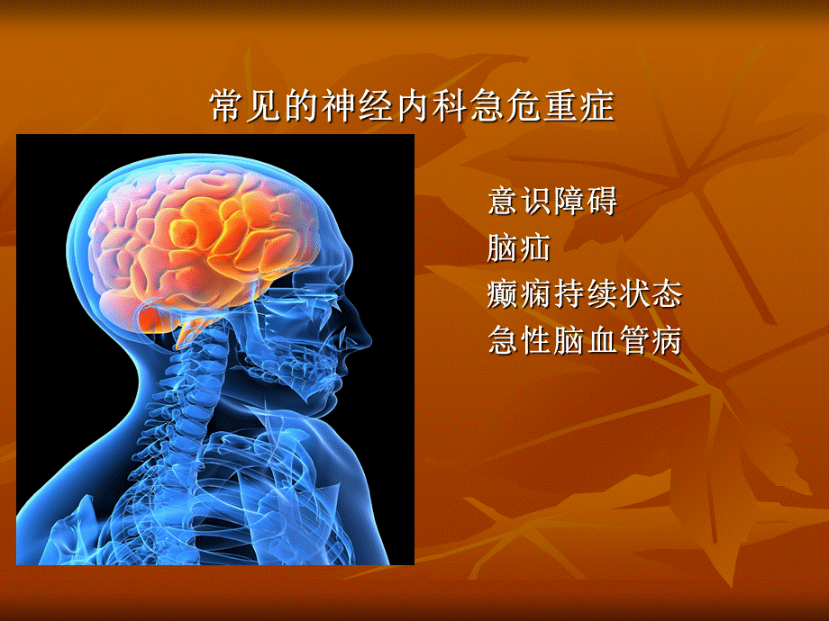 神经内科常见急危重症的诊断和处理.ppt_第2页