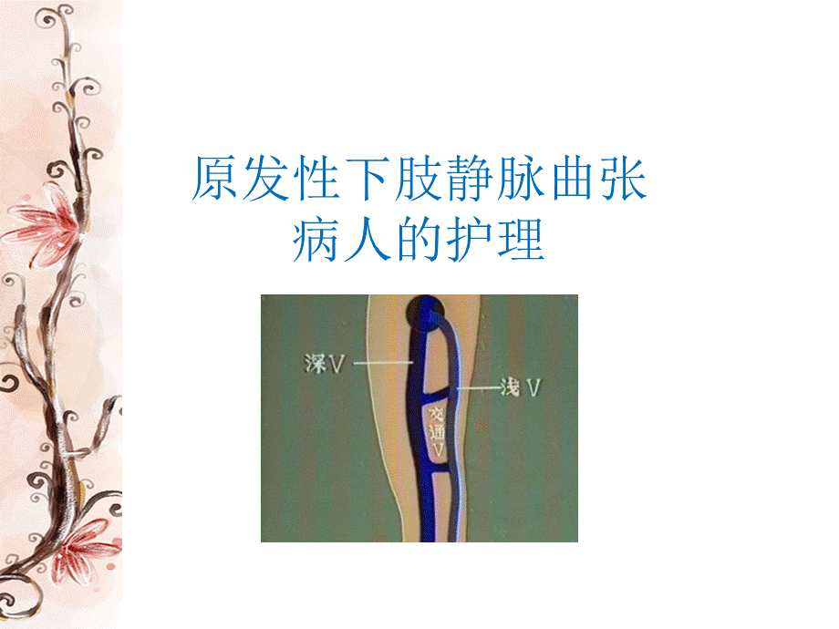 原发性下肢静脉曲张病人的护理课件PPT格式课件下载.pptx_第1页