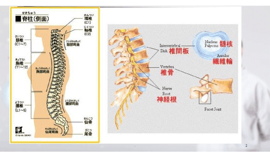 腰椎滑脱症围手术期护理.pptx_第2页