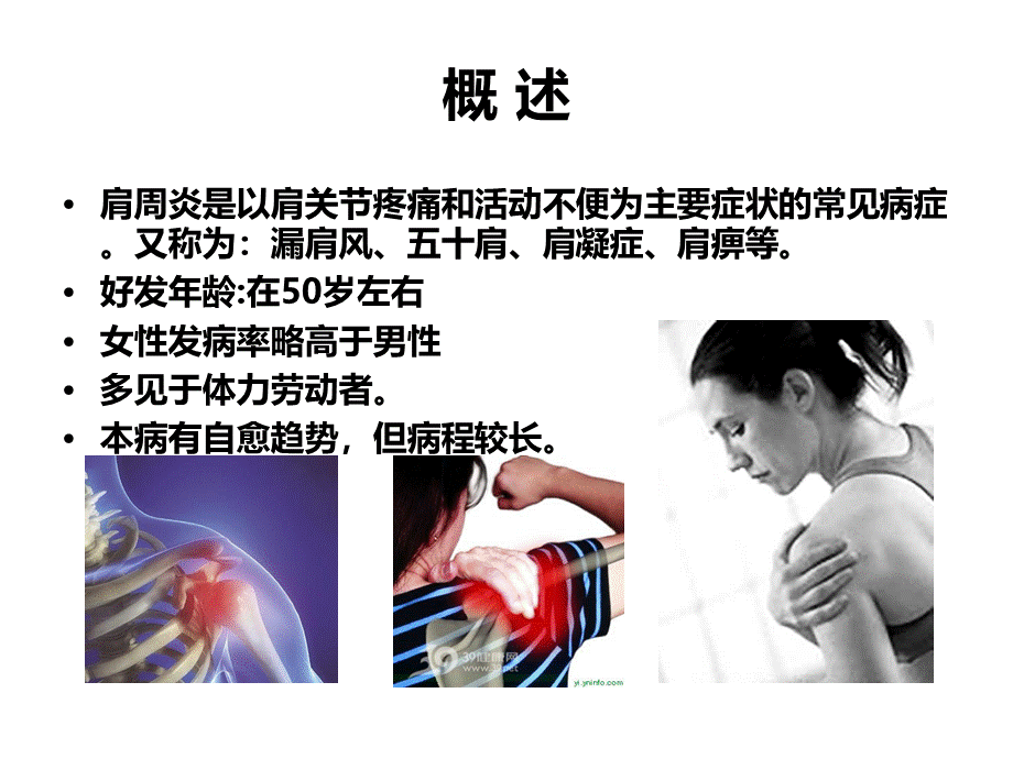 肩周炎的护理PPT课件.ppt_第2页