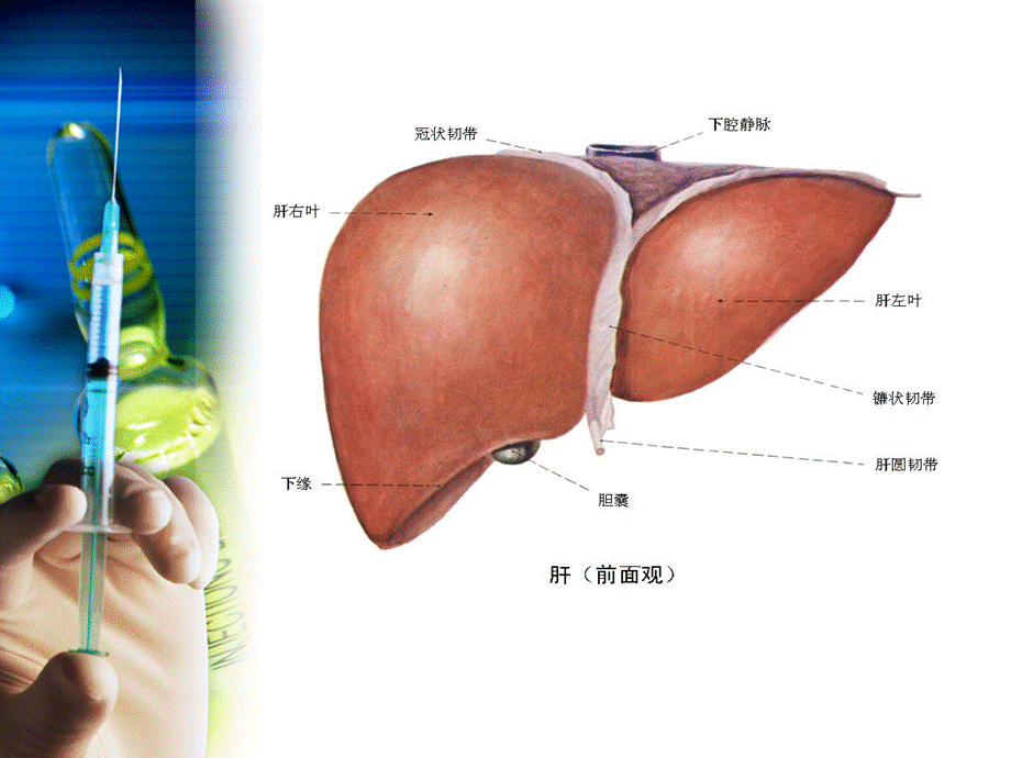 肝癌病人的护理PPT资料.ppt_第3页