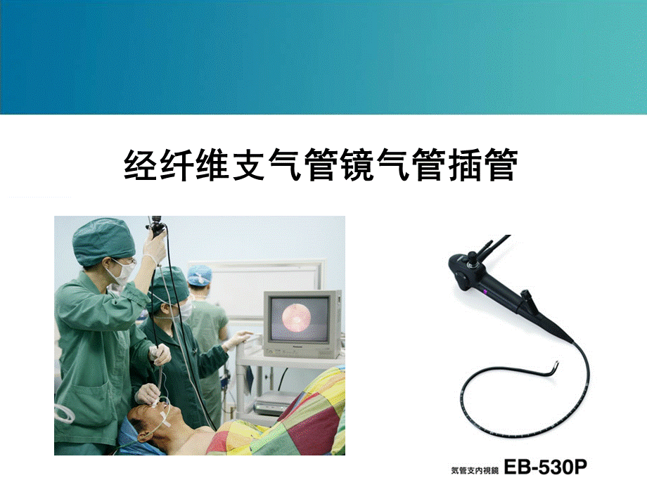 经纤维支气管镜气管插管(PPT课件).ppt_第1页